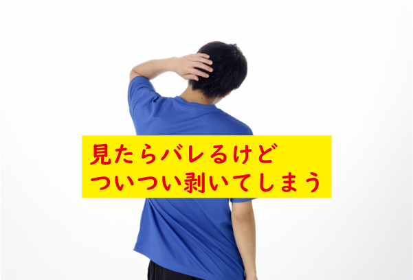 ついつい剥いてしまう